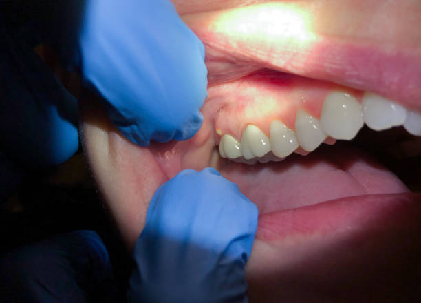 Best Cosmetic Emergency Dentistry in Galva, KS